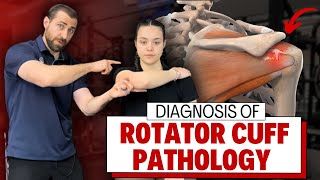 Mastering Rotator Cuff Pathology: Special Tests & Diagnosis