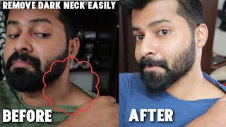 Cure Dark Neck Problem with this Simple Method | 100% Results | Tamil | Shadhikazeez