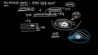 직장에 생긴 유암종(카르시노이드) - 어떻게 치료할 것인가