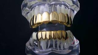 14k Gold Plated 8 Top 6 Bottom Teeth Grillz Set Video