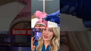 Doctor reacts: cast removal gone wrong