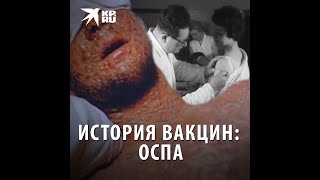 История вакцин: оспа