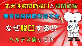 先天性股関節脱臼と股関節痛 ペルテス病って⁉ 脱臼する理由と予防 【医師が解説】