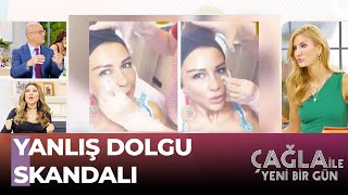 Dolgu Yapmaktan Korkuyorsanız Bu Videoyu İzleyin - Çağla ile Yeni Bir Gün 897. Bölüm