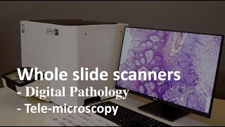 Optimus 6T - Whole Slide Scanner Demo - Digital Pathology Workflow for Tele-pathology, Archival & AI