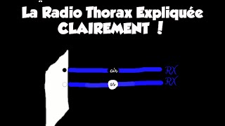 🔴 Dr Astuce - 1 LA RADIO THORAX EXPLIQUÉE CLAIREMENT !