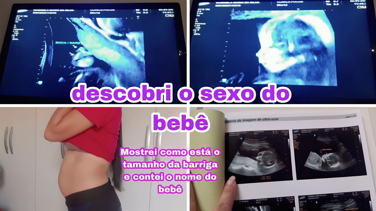 ULTRASSOM MORFOLÓGICA/ 20 SEMANAS/ DESCOBRINDO O SEXO DO BEBÊ 😍🤰 - YouTube