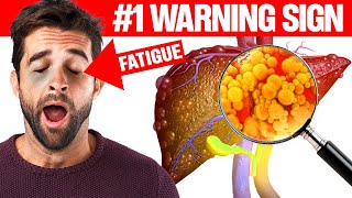 6 Early Warning Signs of FATTY LIVER