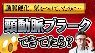 【動脈硬化】頸動脈プラークができる理由と対策やるべき検査を医師が解説【循環器専門医】