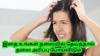 இதை உங்கள் தலையில் தேய்த்தால் தலை அரிப்பு போய்விடும் Rub this on your head to get rid of itchy scalp