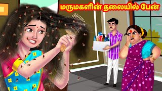 மருமகள் தலையில் பேன்  Mamiyar vs Marumagal | Tamil Stories | Tamil Kathaigal | Anamika TV Tamil