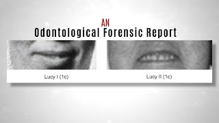 Odontological Forensic Report - SLT