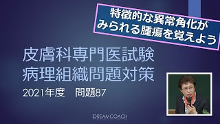 皮膚科専門医試験問題の解説　2021年度問題　問題87