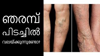 ഈ അസുഖം നിങ്ങളെ വലക്കുന്നുണ്ടോ||Health Tips Malayalam