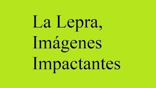 La Lepra, imágenes impactantes