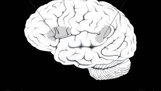 Cognitive psychology | Wikipedia audio article