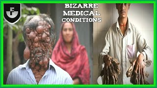 11 People With The Most Bizarre Medical Conditions