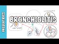 Bronchiolitis (causes, pathophysiology, signs and symptoms, treatment)