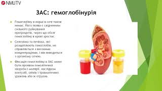 Відеолекція: Загальний аналіз сечі: Органолептичні властивості