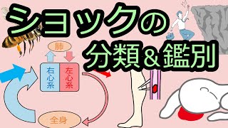 【ショック】ショックの分類と鑑別方法