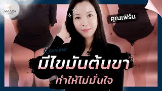 ตัวเล็กแต่ขาใหญ่ ไม่มั่นใจ! รีวิวดูดไขมันปีกสะโพก ต้นขาปลิ้น