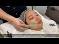 How to Get Korean Glass Skin - Mirage Aesthetic Premium Glow Treatment