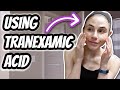 Vlog: TRANEXAMIC ACID SKIN CARE ROUTINE | Dr Dray