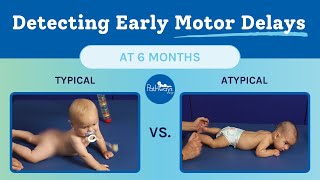 6 Month Typical \u0026 Atypical Motor Development | Baby Motor Development Exam