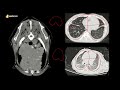 thorax anatomy shape