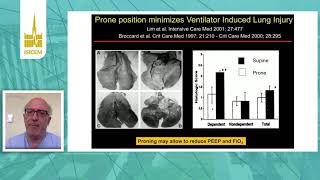 ISICEM, ARDS, How to use PEEP in the prone position, Paolo  Pelosi Genoa, Italy