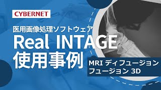 Real INTAGE MRI ディフュージョン フュージョン 3D