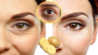 in 3 days Remove Under Eye Wrinkles Completely - Remove Dark Circles, Bags Eyes