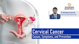 Cervical Cancer: Causes, Symptoms, and Prevention | Yashoda Hospitals Hyderabad