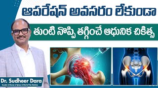 Avascular Necrosis of Hip Joint in Telugu || Hip Joint Pain Relief || Dr Sudheer Dara || Epione