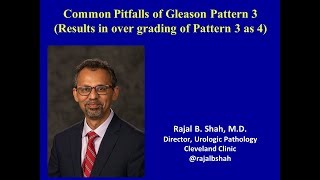 Common Pitfalls of Gleason Pattern 3 (Overgrading of Pattern 3 as 4)