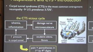 Neuroimaging Potential Brain Mechanisms for Acupuncture: From Carpal Tunnel Syndrome to Fibromyalgia