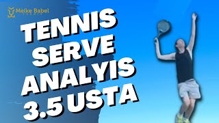 Tennis Serve Analysis 3.5 USTA player