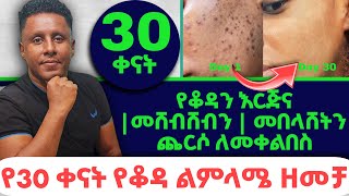 Ethiopia | #የቆዳን እርጅና | #በሸብሸብን | #መበላሸትን ጨርሶ ልመቀልበስ | የ30 ቀናት የቆዳ ልምላሜ ዘመቻ