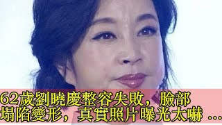 62歲劉曉慶整容失敗，臉部塌陷變形，真實照片曝光太嚇人 !