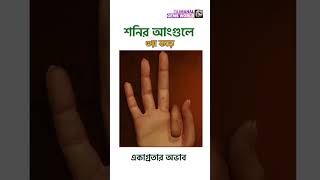 What happens if there is a mole on Saturn's finger 3 II শনির আংগুলে তিল থাকলে কি হয় ৩