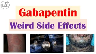 Gabapentin Weird Side Effects (Skin, Psychological, Eyes)