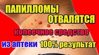 БОРОДАВКИ И ПАПИЛЛОМЫ ОТВАЛЯТСЯ САМИ. КОПЕЕЧНОЕ СРЕДСТВО ИЗ АПТЕКИ