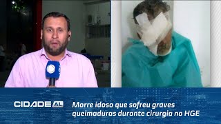 Morre idoso que sofreu graves queimaduras durante cirurgia no HGE, Maceió