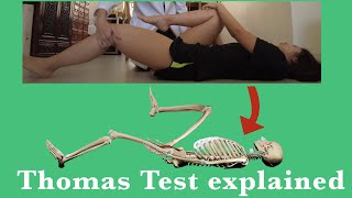 Thomas Test explained