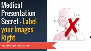 Medical Presentation Secrets  : Label Images Right