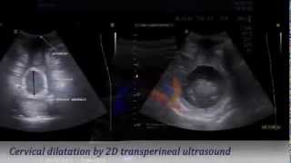 ISUOG Advanced course: Ultrasound and delivery decisions