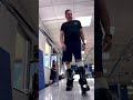 partial foot amputee prosthetic training mastering mobility