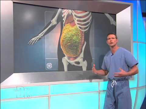 Fast Food s Effect on the Body Medical Course Fast Food s Effect on the Body Medical Course