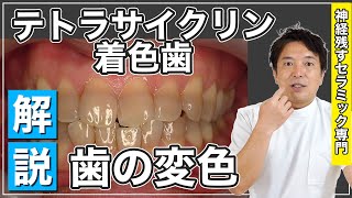 「歯が黒い」ことで長年お悩みの方へ…【テトラサイクリンとは…？】