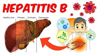 Hepatitis B!